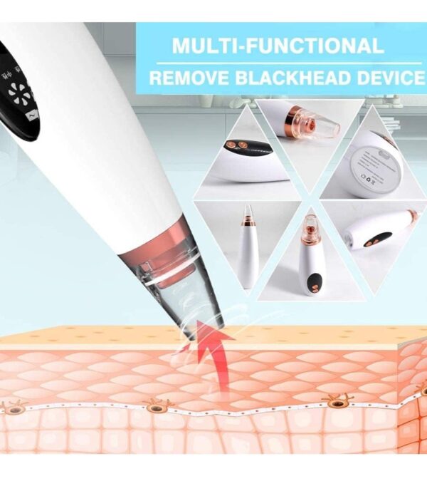 Multi-function Blackhead Remover Tools Electric Derma suction Machine... - Image 5